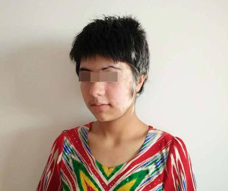 白癜風(fēng)最新治療方法研究與應(yīng)用進(jìn)展